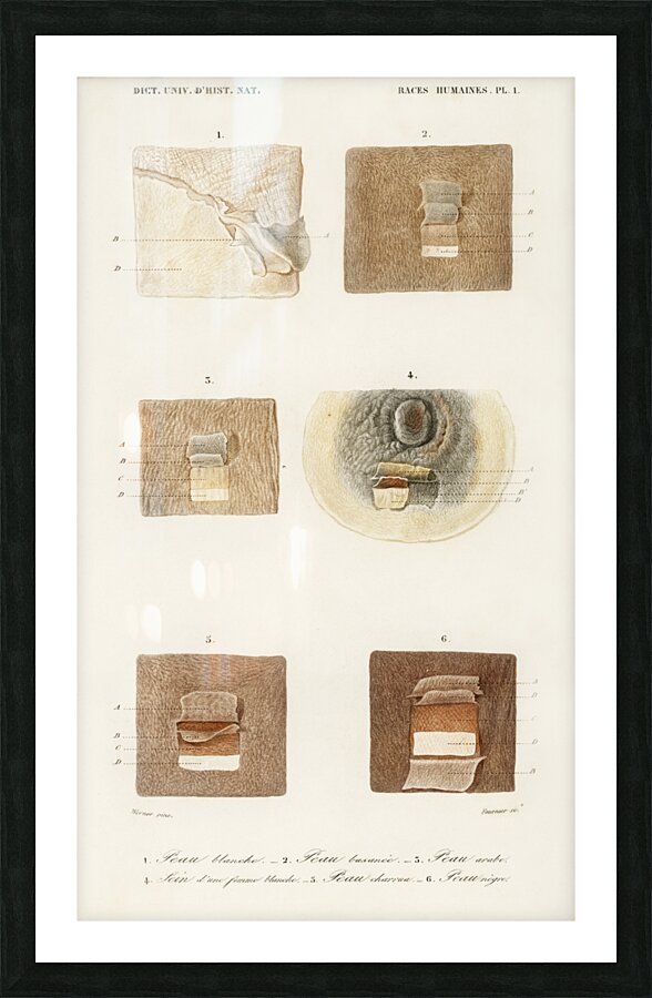 Human skin layers Picture Frame print