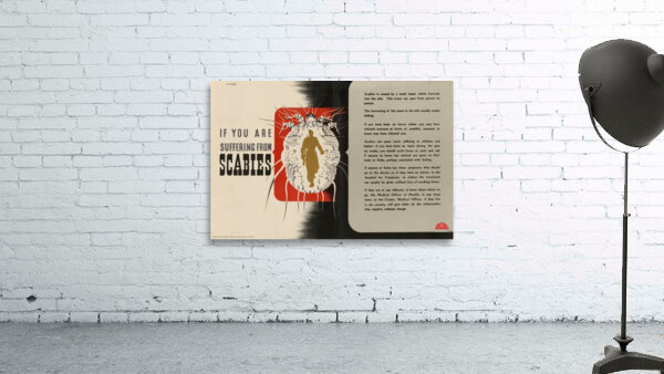 If You are Suffering from Scabies Wall Preview