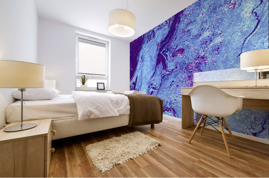 Thermal Mural print