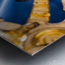 medtech hope Metal print