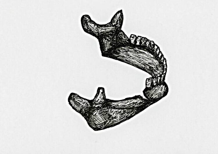 Broken Jaw by Jon David