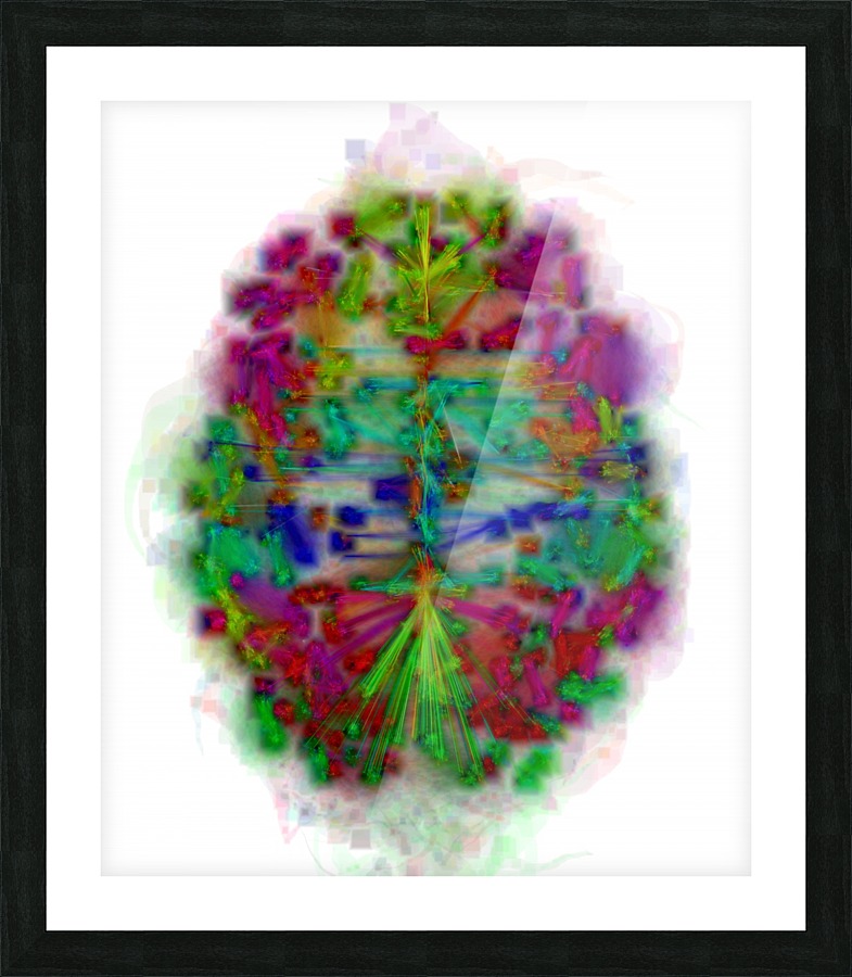 MISTy Brain Picture Frame print
