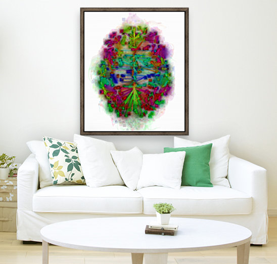 MISTy Brain Reproduction