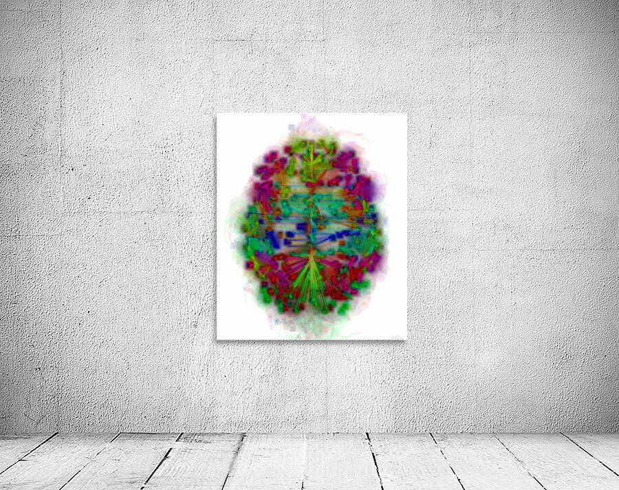 MISTy Brain Wall Preview