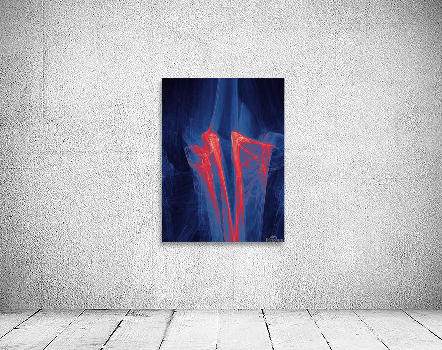 Companion  Wall Preview