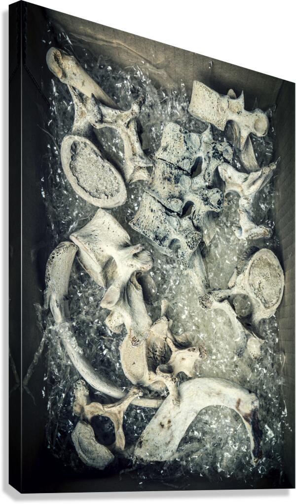 human bone vertebrae in a cardboard box  Canvas Print