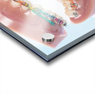 Orthodontics Acrylic print