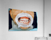 Healthy Gums Acrylic Print
