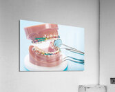 Orthodontics Acrylic Print