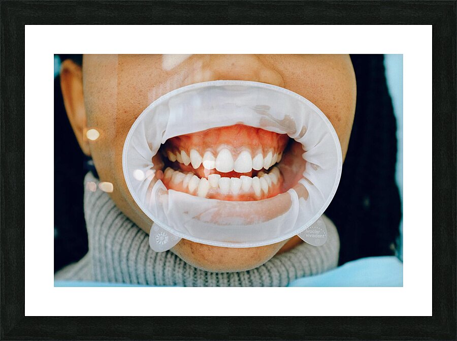 Healthy Gums Picture Frame print