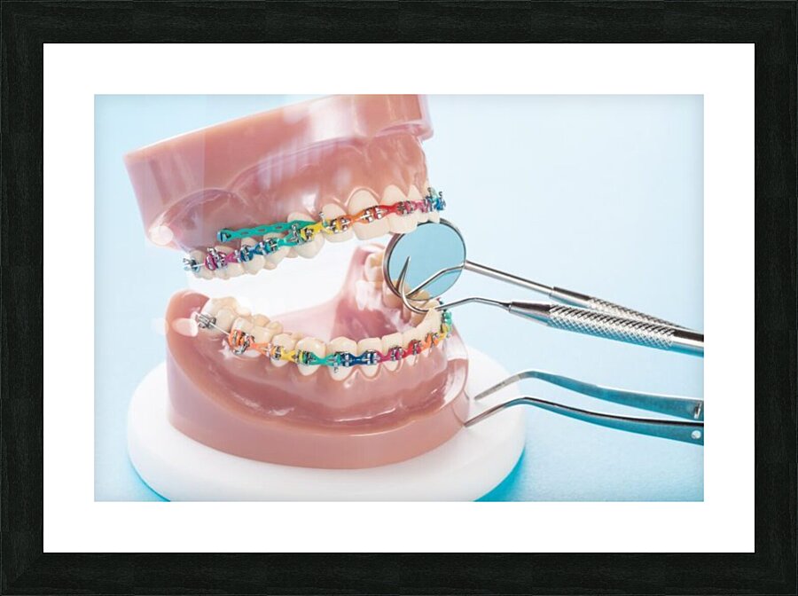 Orthodontics Picture Frame print