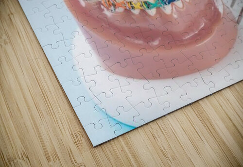Orthodontics Dr Richard Halpern Orthodontist Calgary puzzle