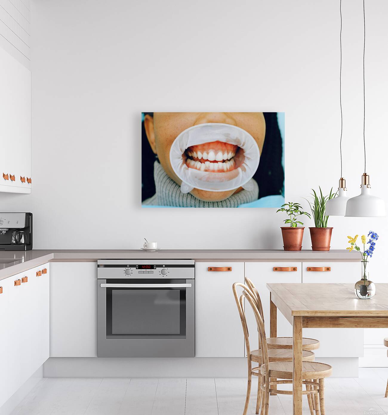 Healthy Gums Reproduction