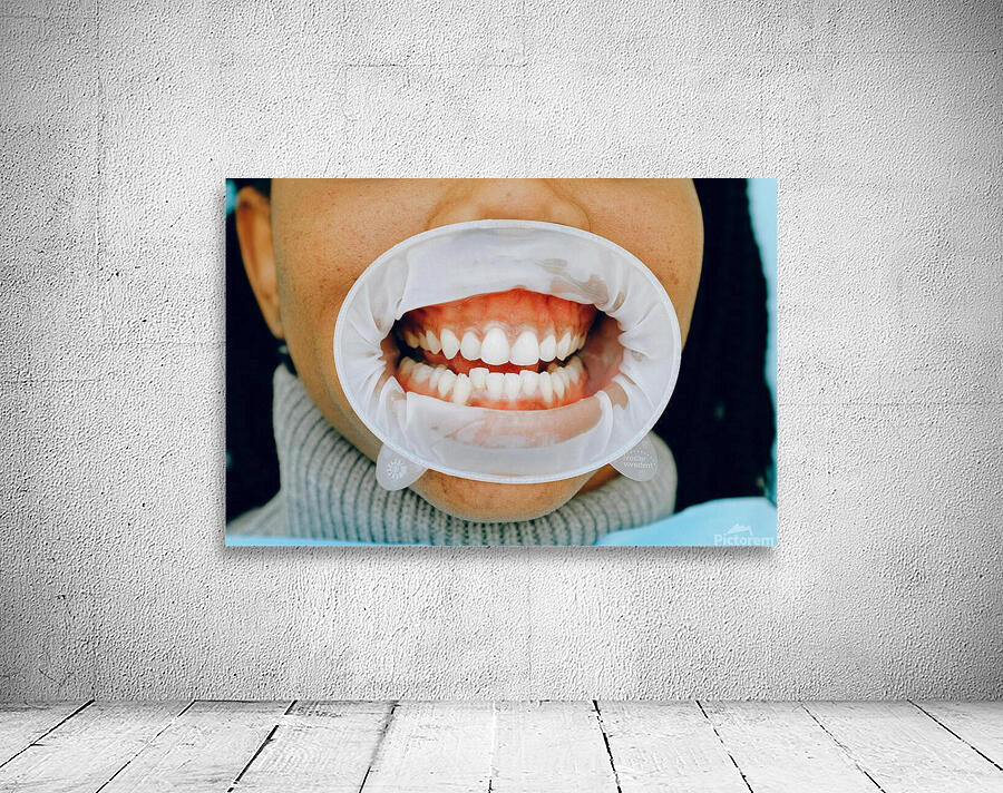 Healthy Gums Wall Preview