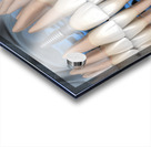 Teeth recovery with implants x-ray view. Acrylic print