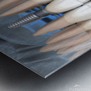 Teeth recovery with implants x-ray view. Metal print