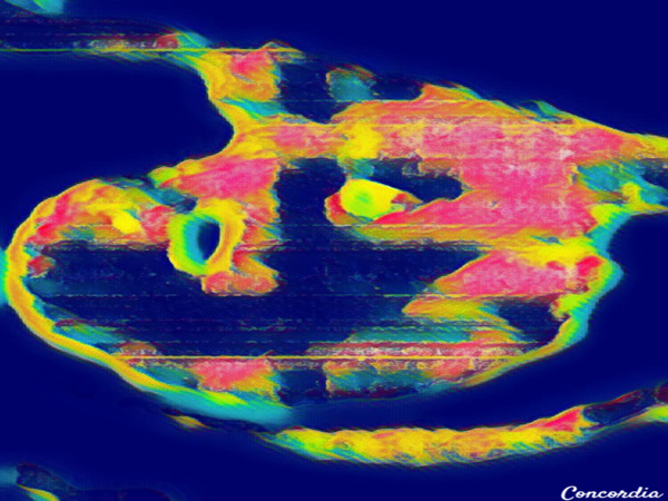 The Eye 9 Digital Download