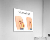 Visceral fat Acrylic Print