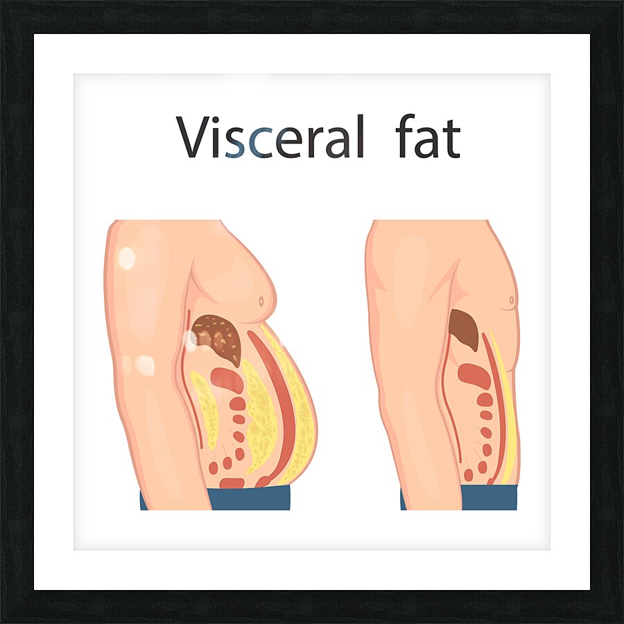 Visceral fat Picture Frame print