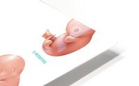 Human Fetus HD Metal print