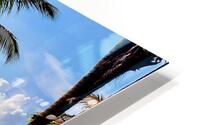Lay Down on the Grass and Enjoy HD Metal print