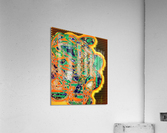 GBM Recurrence Acrylic Print