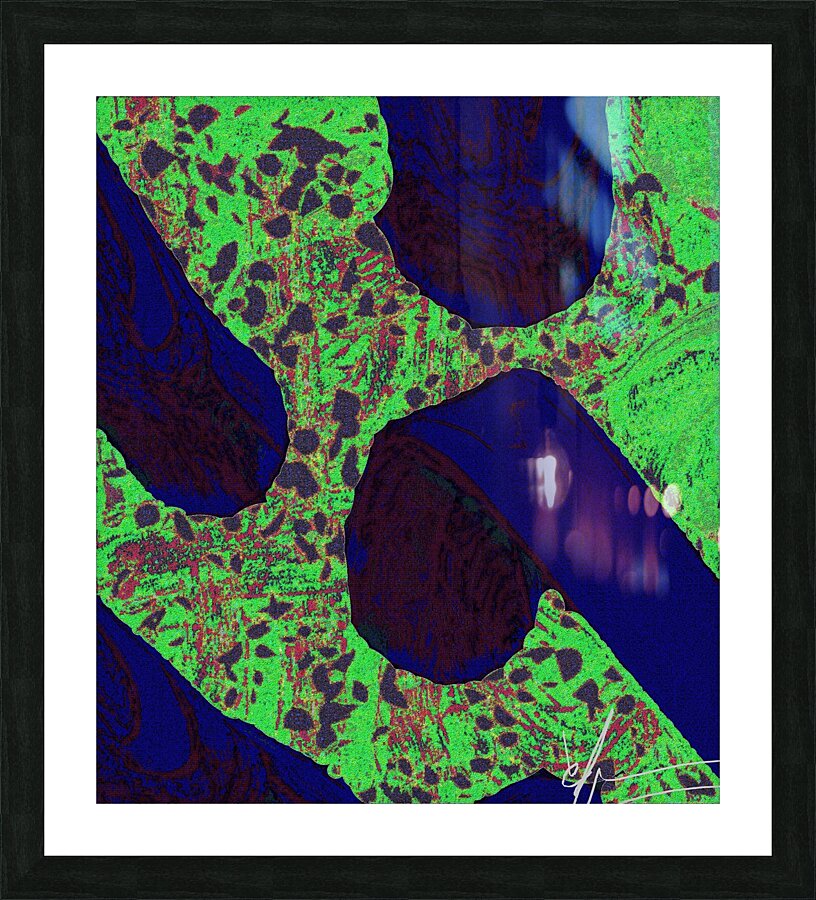 Follicles & Dermis Picture Frame print