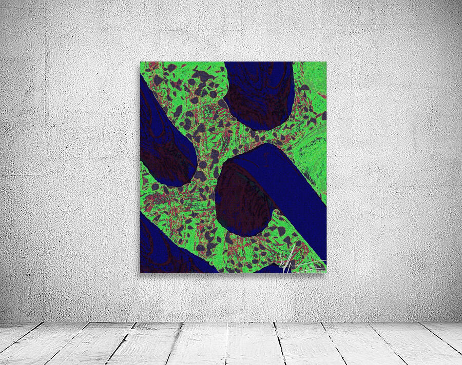 Follicles & Dermis Wall Preview