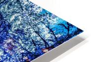 A Peek Through The Forest HD Metal print